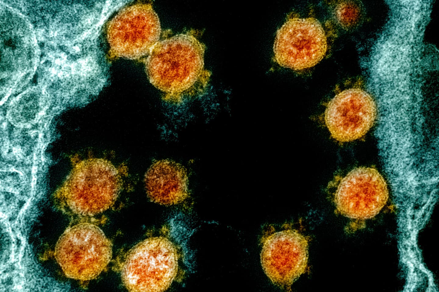 The CDC model found that people without symptoms spread the virus in more than half of cases